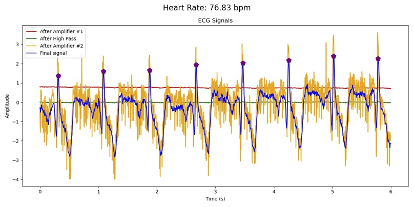 Photo of live usage of the 3-lead ECG system