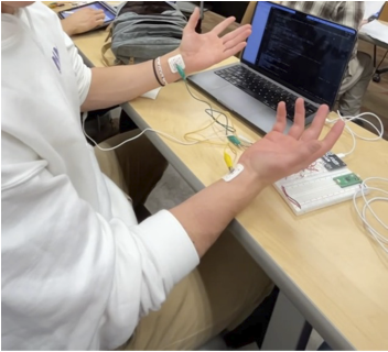 Photo of live usage of the 3-lead ECG system